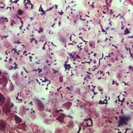 thumbnail for publication: Preventing Foodborne Illness: Listeriosis